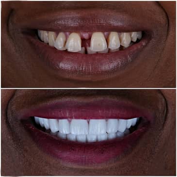 Slider image (4) Uzmanlar Dental Clinic